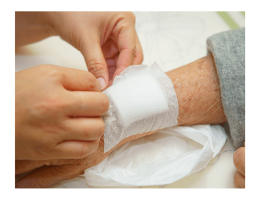 Wound Healing